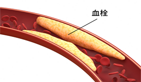 &#122;&#111;&#116;&#121;&#20013;&#27431;